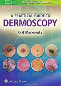 A Practical Guide to Dermoscopy