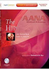 AANA Advanced Arthroscopy: The Hip **