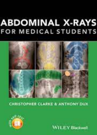 Abdominal X-rays for Medical Students