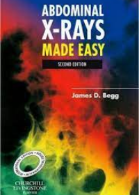 Abdominal X-Rays Made Easy, IE, 2nd Edition