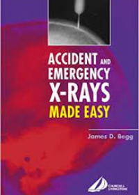 Accident & Emergency X-Rays Made Easy