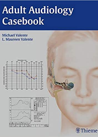 Adult Audiology Casebook, 2e