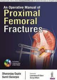 An Operative Manual of Proximal Fractures 