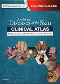 Andrews' Diseases of the Skin Clinical Atlas