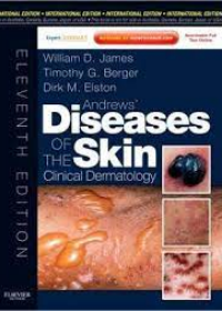 Andrews' Diseases of the Skin, IE, 11e **