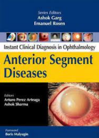 Anterior Segment Diseases