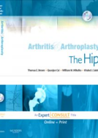 Arthritis and Arthroplasty: The Hip, Expert Consult - Online, Print and DVD