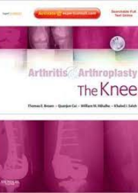 Arthritis and Arthroplasty: The Knee: Expert Consult: Online, Print and DVD **