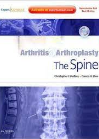 Arthritis and Arthroplasty: The Spine **