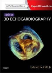 Atlas of 3D Echocardiography, 2e