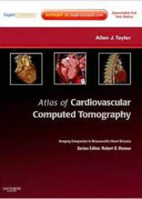 Atlas of Cardiovascular Computed Tomography **