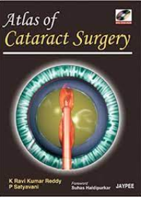 Atlas of Cataract Surgery