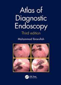 Atlas of Diagnostic Endoscopy, 3E