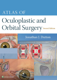 Atlas of Oculoplastic and Orbital Surgery, 2e