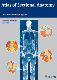 Atlas of Sectional Anatomy