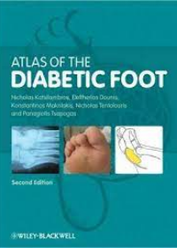 Atlas of the Diabetic Foot, 2e **