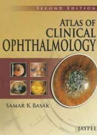 Atlas on Clinical Ophthalmology 2/e