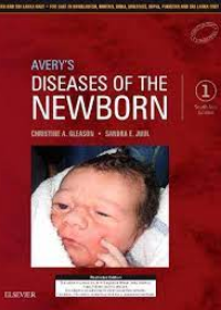 Avery's Diseases of the Newborn: First South Asia Edition