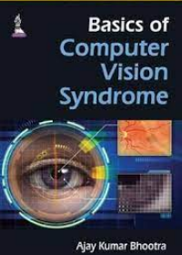 Basics of Computer Vision Syndrome