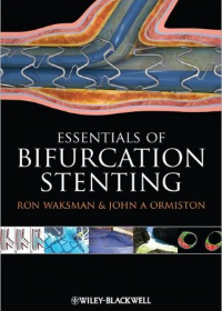 Bifurcation Stenting