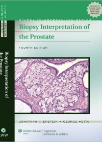 Biopsy Interpretation of the Prostate, 4e **