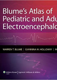 Blume's Atlas of Pediatric and Adult Electroencephalography