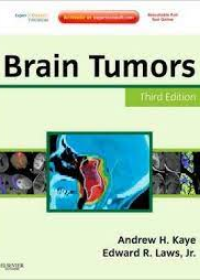 Brain Tumors, 3e **