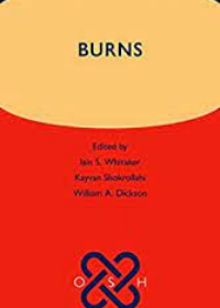 Burns (Oxford Specialist Handbooks)