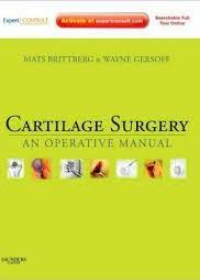 Cartilage Surgery **