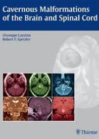 Cavernous Malformations of the Brain and Spinal Cord **