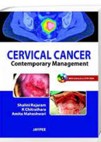 Cervical Cancer : Contemporary Management