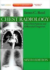 Chest Radiology, 6e **