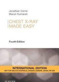 Chest X-Ray Made Easy IE, 4e