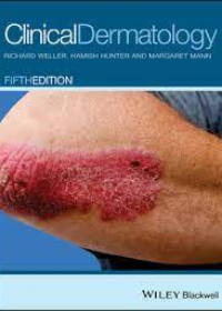 Clinical Dermatology, 5e