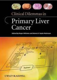 Clinical Dilemmas in Liver Cancer