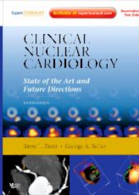 Clinical Nuclear Cardiology State of the Art and Future Directions, 4e