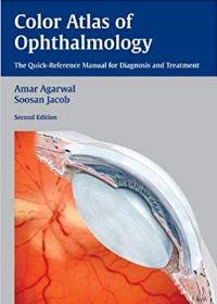 Color Atlas of Ophthalmology: The Quick-Reference Manual for Diagnosis and Treatment, 2e