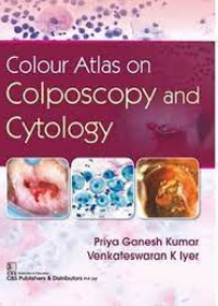 Colour Atlas on Colposcopy and Cytology (HB)