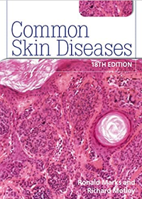 Common Skin Diseases, 18e