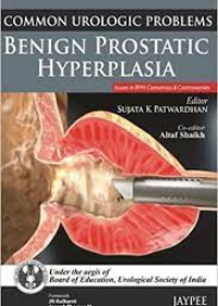 Common Urologic Problems Benign Prostatic Hyperplasia