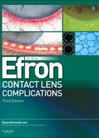 Contact Lens Complications, 3e **