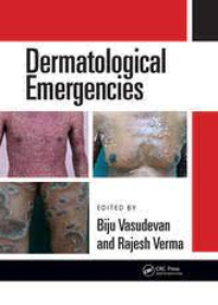 Dermatological Emergencies