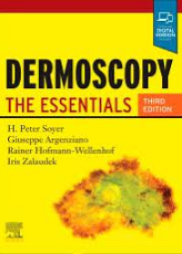 Dermoscopy , The Essentials , 3rd Edition