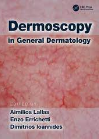 Dermoscopy in General Dermatology