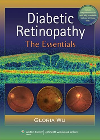 Diabetic Retinopathy