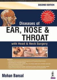 Diseases of Ear, Nose and Throat, 2e