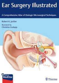 Ear Surgery Illustrated