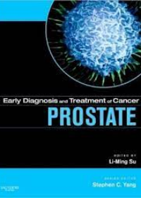 Early Diagnosis and Treatment of Cancer Series: Prostate Cancer **