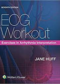 ECG Workout: Exercises in Arrhythmia Interpretation, 7e