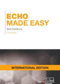 Echo Made Easy IE, 3rd Edition